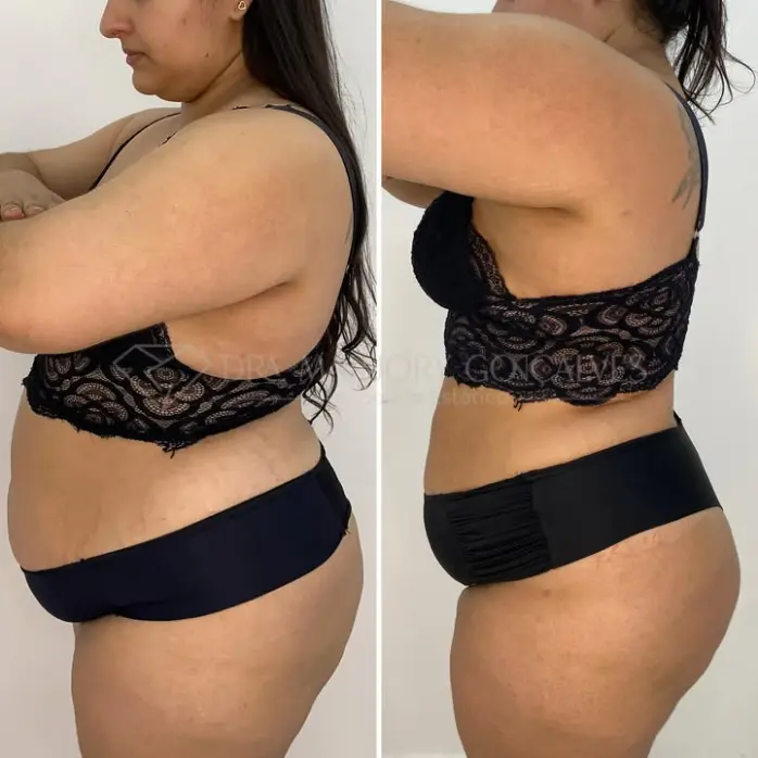 Resultado de emagrecimento